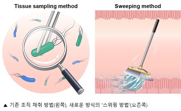 왼쪽은 기존 조직 채취 검사,오른쪽은 새로운 방식의 '스위핑 방법'(사진=아주대병원)