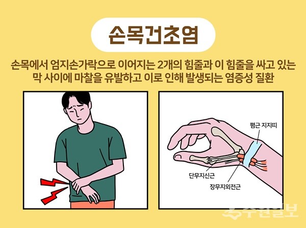 손목건초염 이미지. (자료=수원나누리병원)